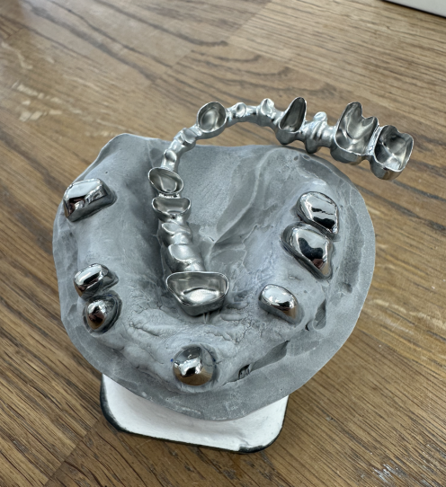 zahnschiene metall