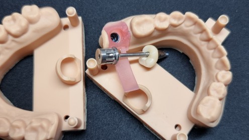 implantologie vorlage