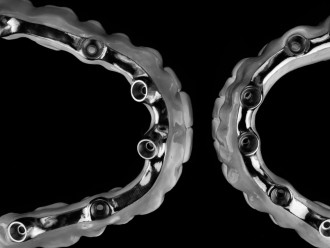 zahnschienen gespiegelt